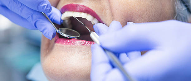 Best Emergency Cosmetic Dentistry (e.g., broken veneers) in Ferguson, MO
